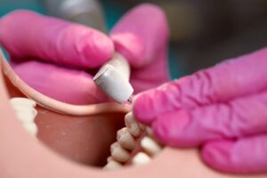 Estetyczne odbudowy zębów – dlaczego warto skorzystać z pomocy protetyka? 2 Estetyczne odbudowy zebow – dlaczego warto skorzystac z pomocy protetyka