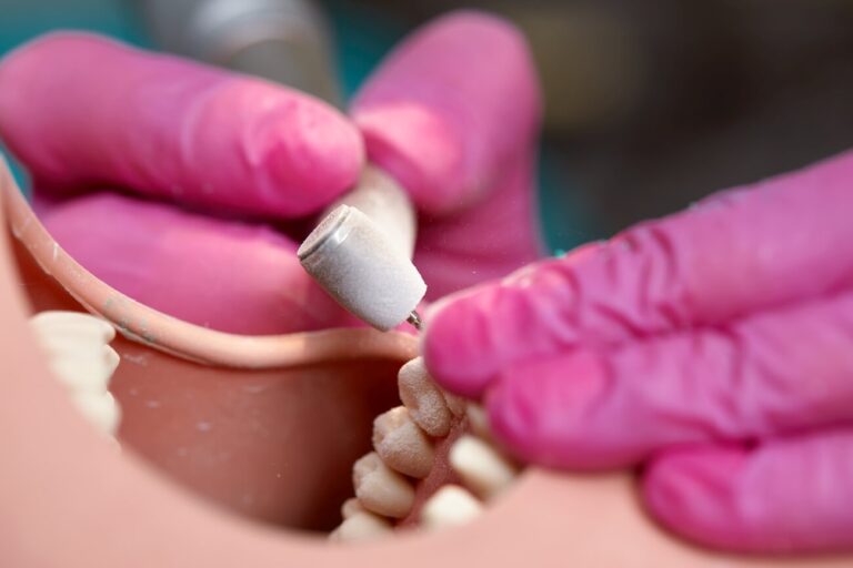 Estetyczne odbudowy zebow – dlaczego warto skorzystac z pomocy protetyka